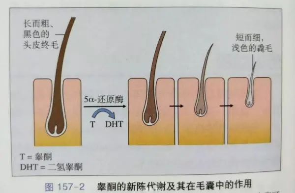 每天掉50-60根头发是正常的,超过多少是不正常呢?