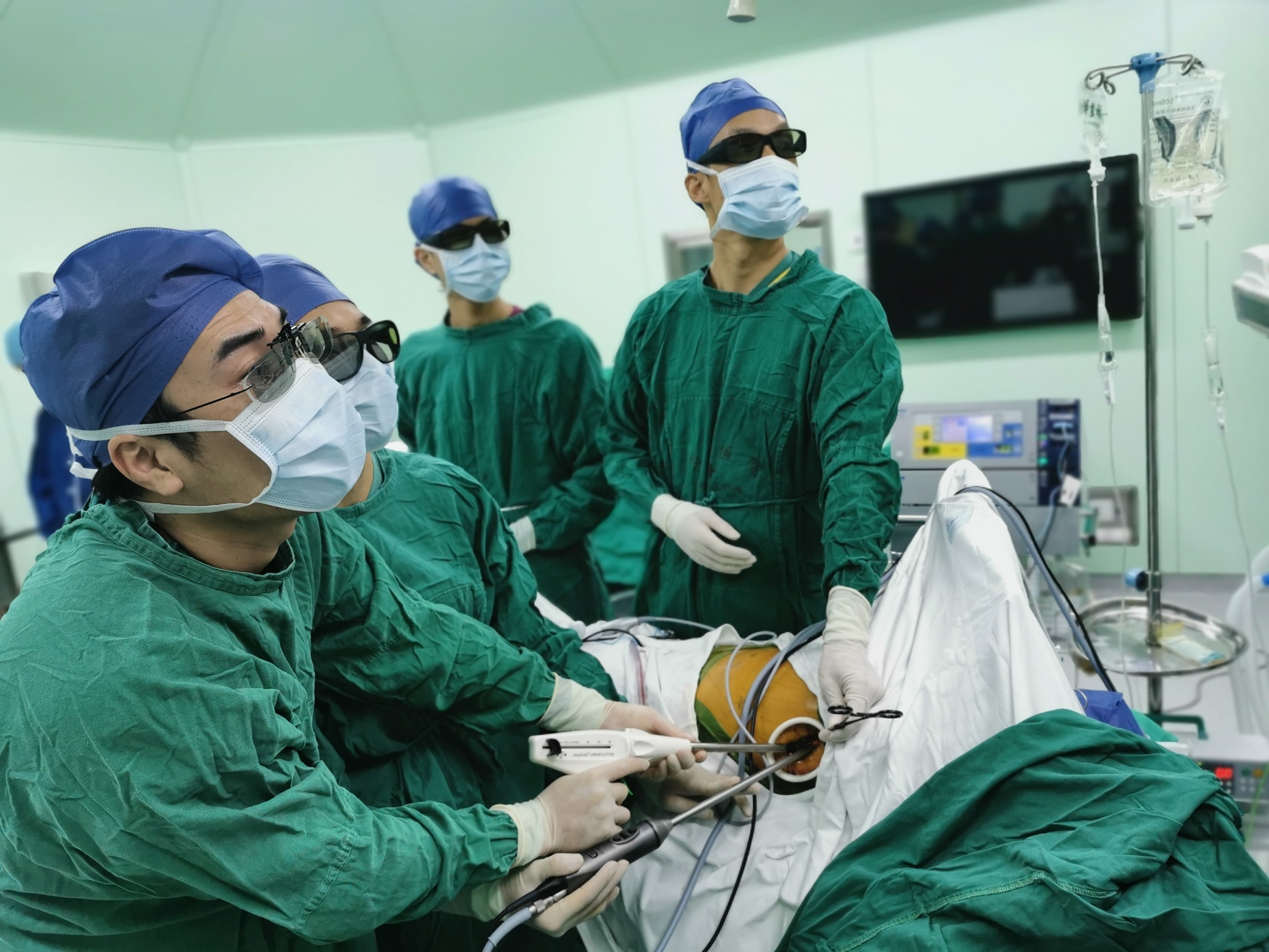 上海长征医院开展国内首例单孔 3d胸腔镜联合腹腔镜食管癌根治术
