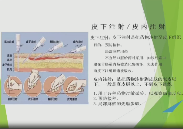 皮下角度注射图片