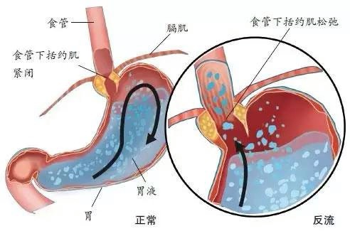 胃镜检查的解剖位置图图片