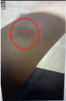 袁小虎向记者展示左前臂被打伤的痕迹 