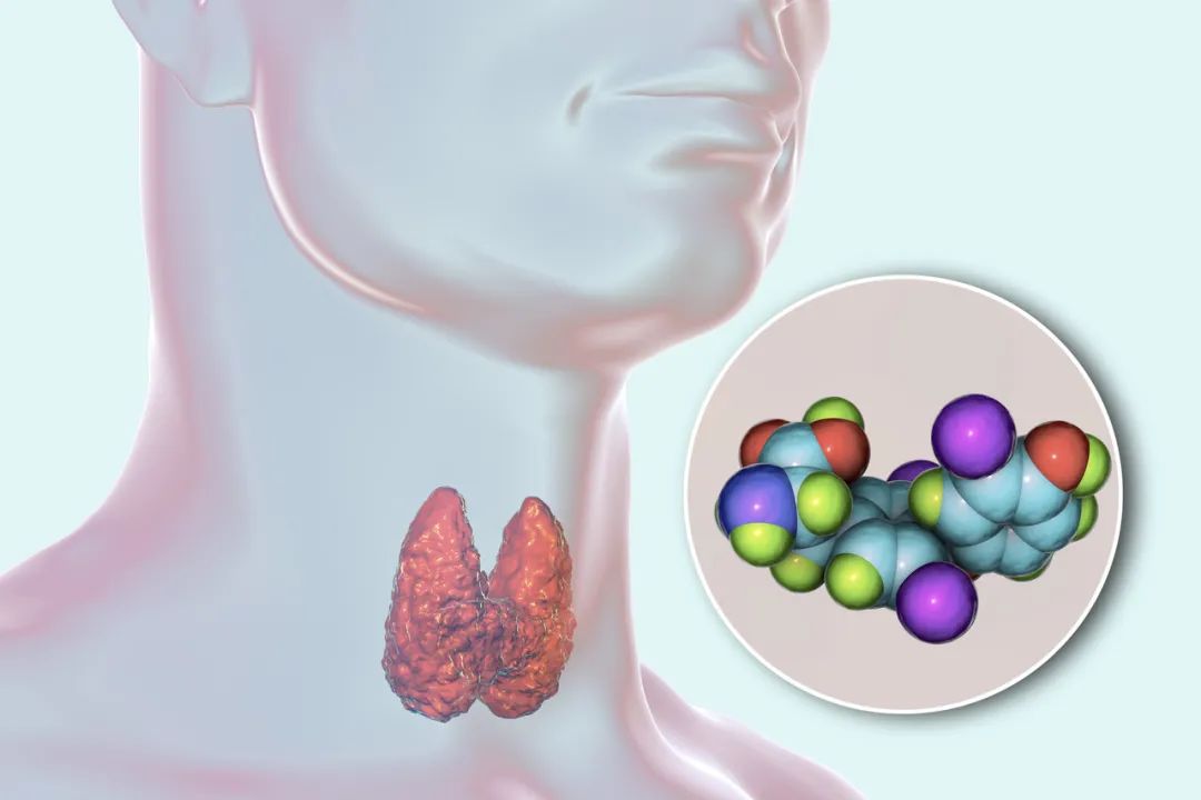 胸闷、气短、心悸……也许是甲状腺在“作怪”！