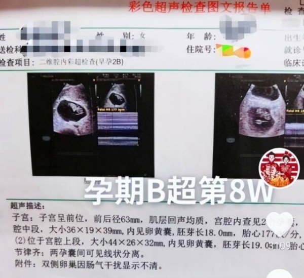 
北京大学第六医院黄牛代挂号电话票贩子号贩子网上预约挂号,住院检查加快,大衣哥儿媳陈萌孕照曝光，朱家开始装修房屋，疑似好事临近