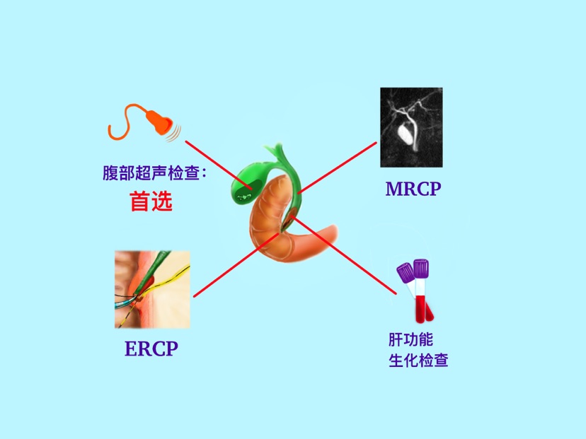 
北京各大医院黄牛代挂号电话票贩子号贩子网上预约挂号,住院检查加快,八成患者没有症状或并发症，但胆囊结石不可忽视！