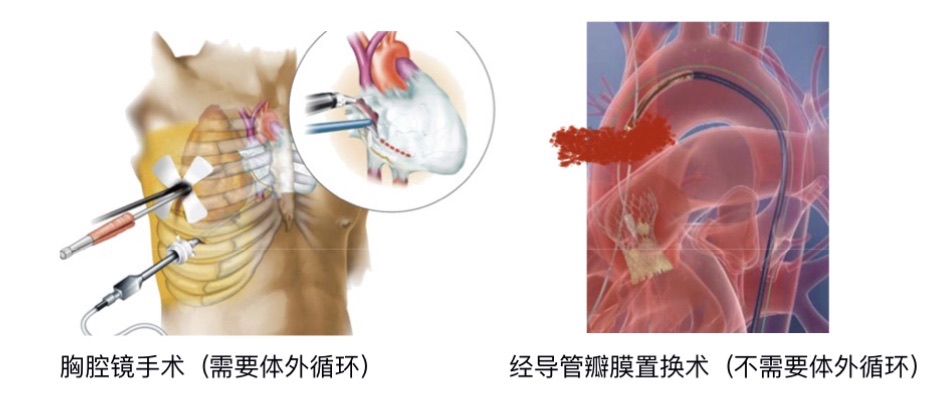 
浙江省中医院黄牛代挂号电话票贩子号贩子网上预约挂号,住院检查加快,科普｜心血管外科医生带你走进“心门”