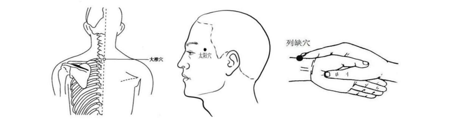 
北京大学第三医院黄牛代挂号电话票贩子号贩子网上预约挂号,住院检查加快,科普｜阳了后感到“头痛、快炸了”？这里有五招中医疗法