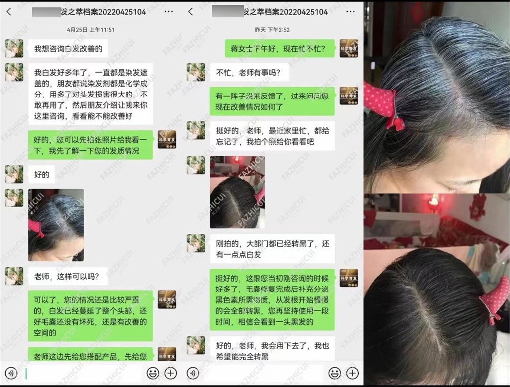 
北医六院黄牛代挂号电话票贩子号贩子网上预约挂号,住院检查加快,2000元防脱发产品进价仅20元 闵行警方捣毁一诈骗团伙