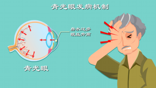 
北京阜外医院黄牛代挂号电话票贩子号贩子网上预约挂号,住院检查加快,光华医院医生提醒：出现这些症状，谨防“青光眼”