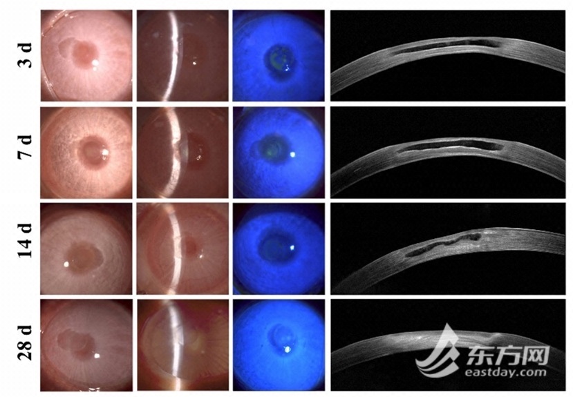 “T.E.S.T.”凝胶治疗新西兰兔角膜缺损模型