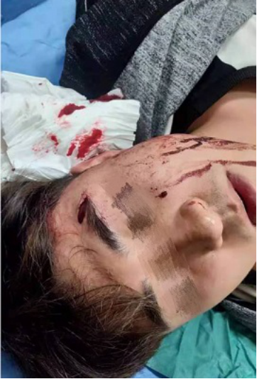 沈阳大学学生因奖学金被同学持刀捅伤,警方:成立专案组提级侦办