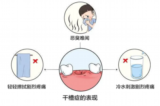 
北京中日友好医院黄牛代挂号电话票贩子号贩子网上预约挂号,住院检查加快,拔智齿不可怕，可怕的是不出血啊……丨健康科普