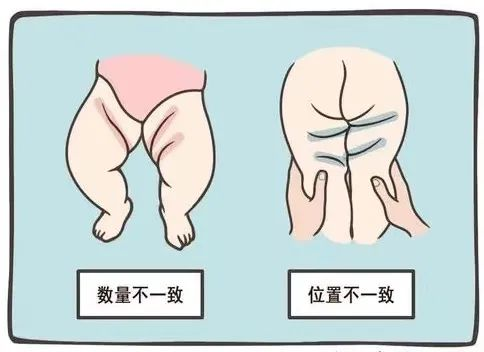 
北京八大处整形医院黄牛代挂号电话票贩子号贩子网上预约挂号,住院检查加快,小儿髋关节超声检查知多少？| 贤医健康说