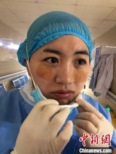 图为区一院医护人员面部皮肤出现压疮。　两江新区第一人民医院供图 摄