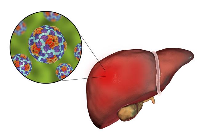 新冠未清,甲肝来袭?疾控专家:可防可控